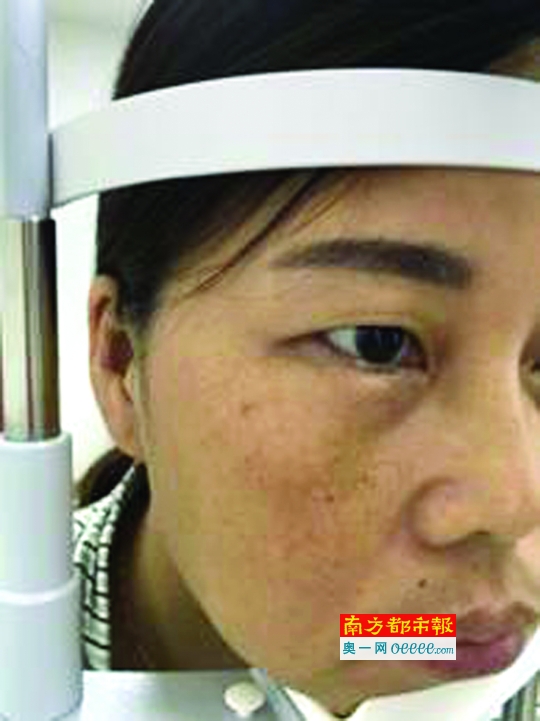 在深圳华厦眼科医院感受国际最先进微创无痛玻